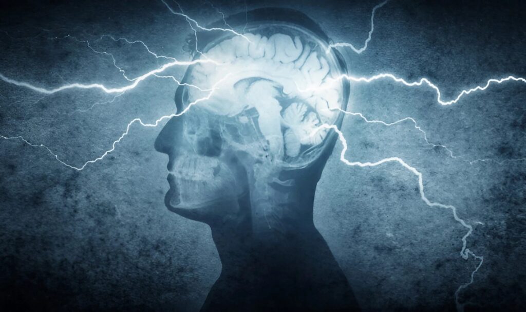 Black Tech: Electrically Stimulating the Brain to Improve Memory